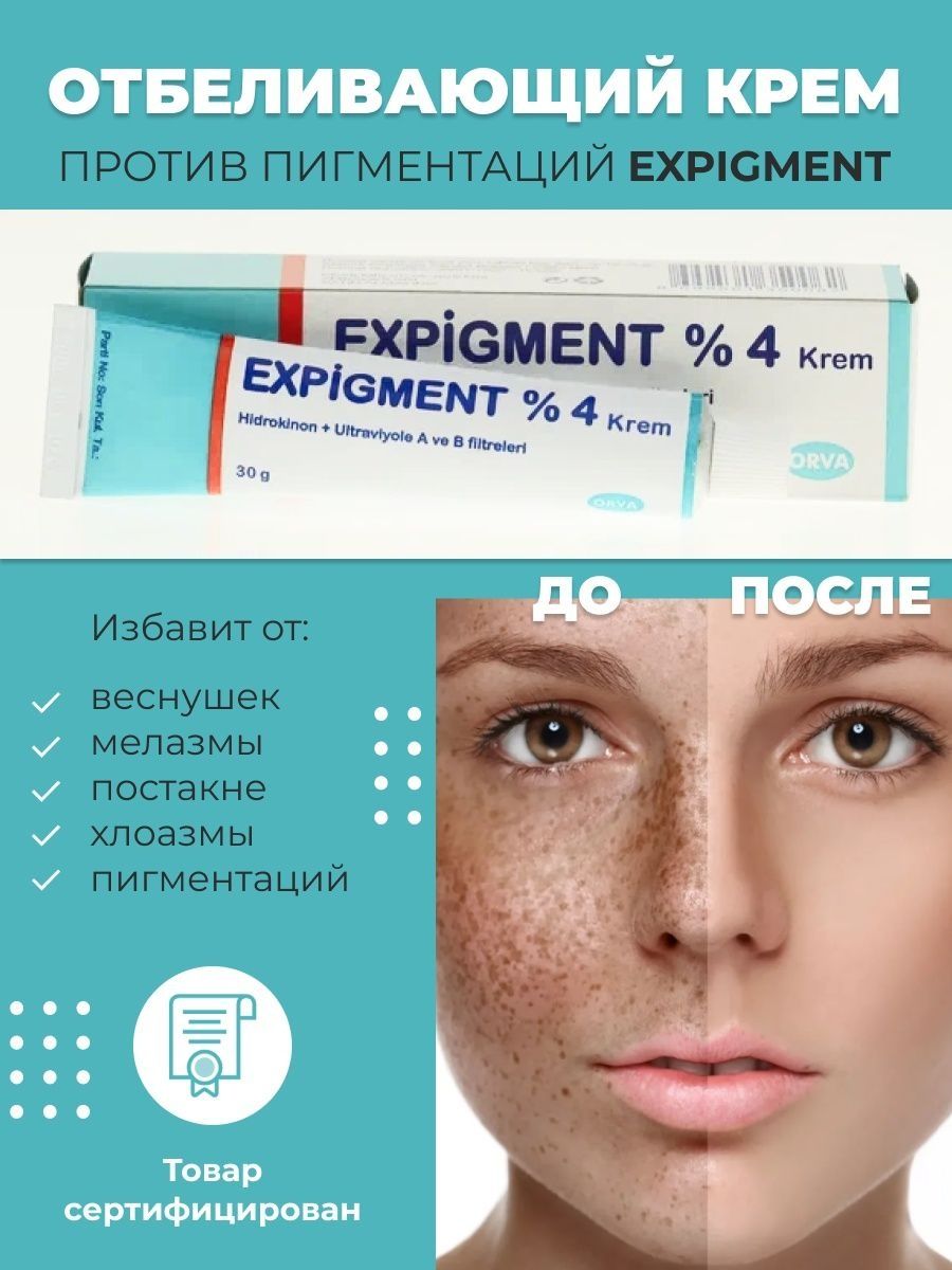 Крем против пигментации для лица отзывы. Постпигментация expigment 4. Expigment крем что делает. Expigment 4 отзывы.