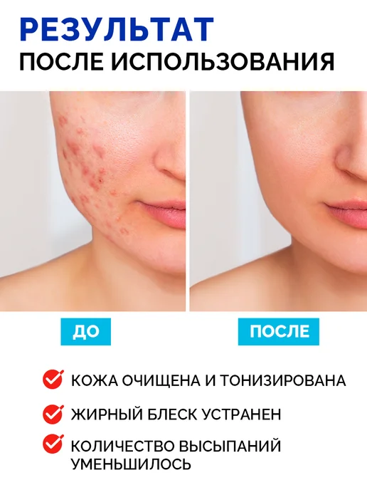 ПРОПЕЛЛЕР Салициловый лосьон от прыщей, 100 мл, 100 мл, фото 4