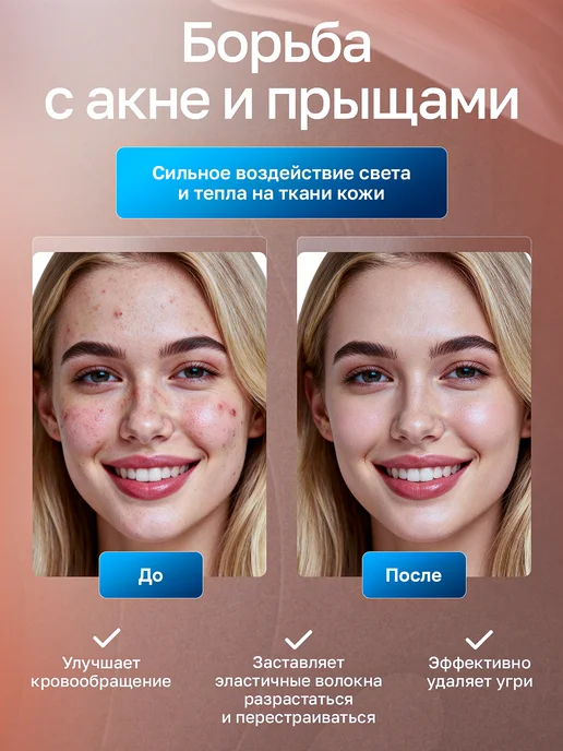 TexnoParts Фотоэпилятор лазерный профессиональный, вариант, фото 2