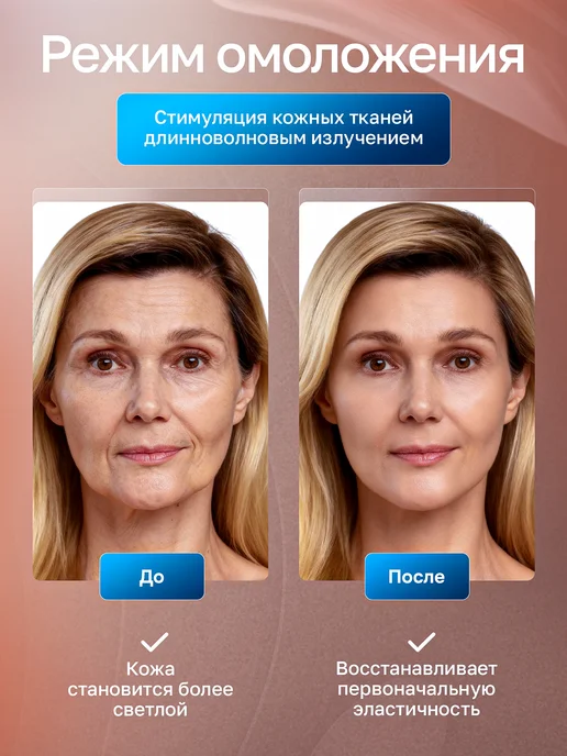 TexnoParts Фотоэпилятор лазерный профессиональный, вариант, фото 5