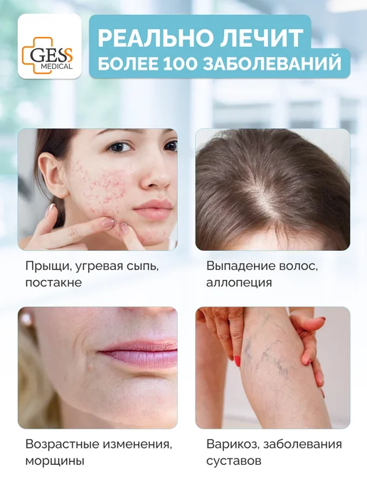 GESS Медицинский дарсонваль для лица и волос против акне Dars, серый, фото 3