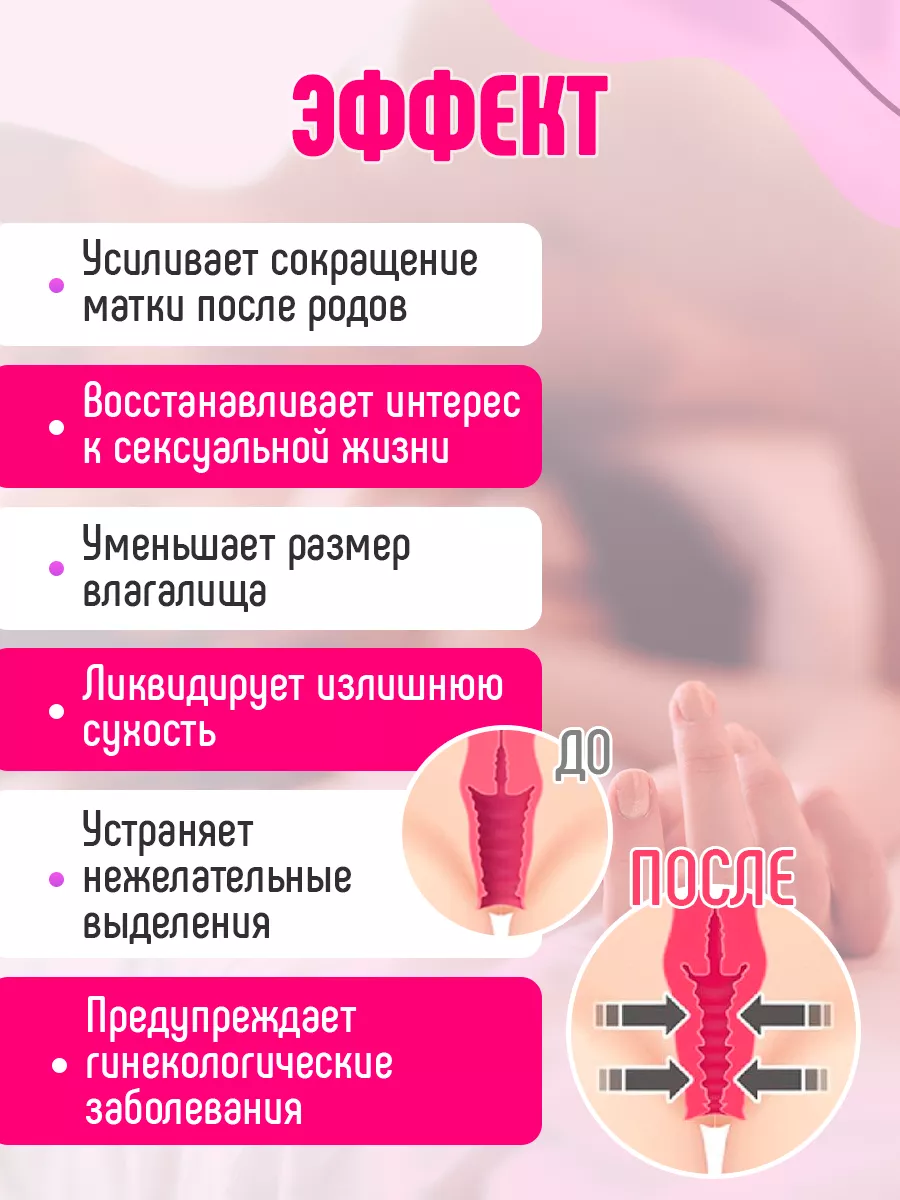 Как сузить влагалище: 5 методов интимной пластики - Медицинский центр 