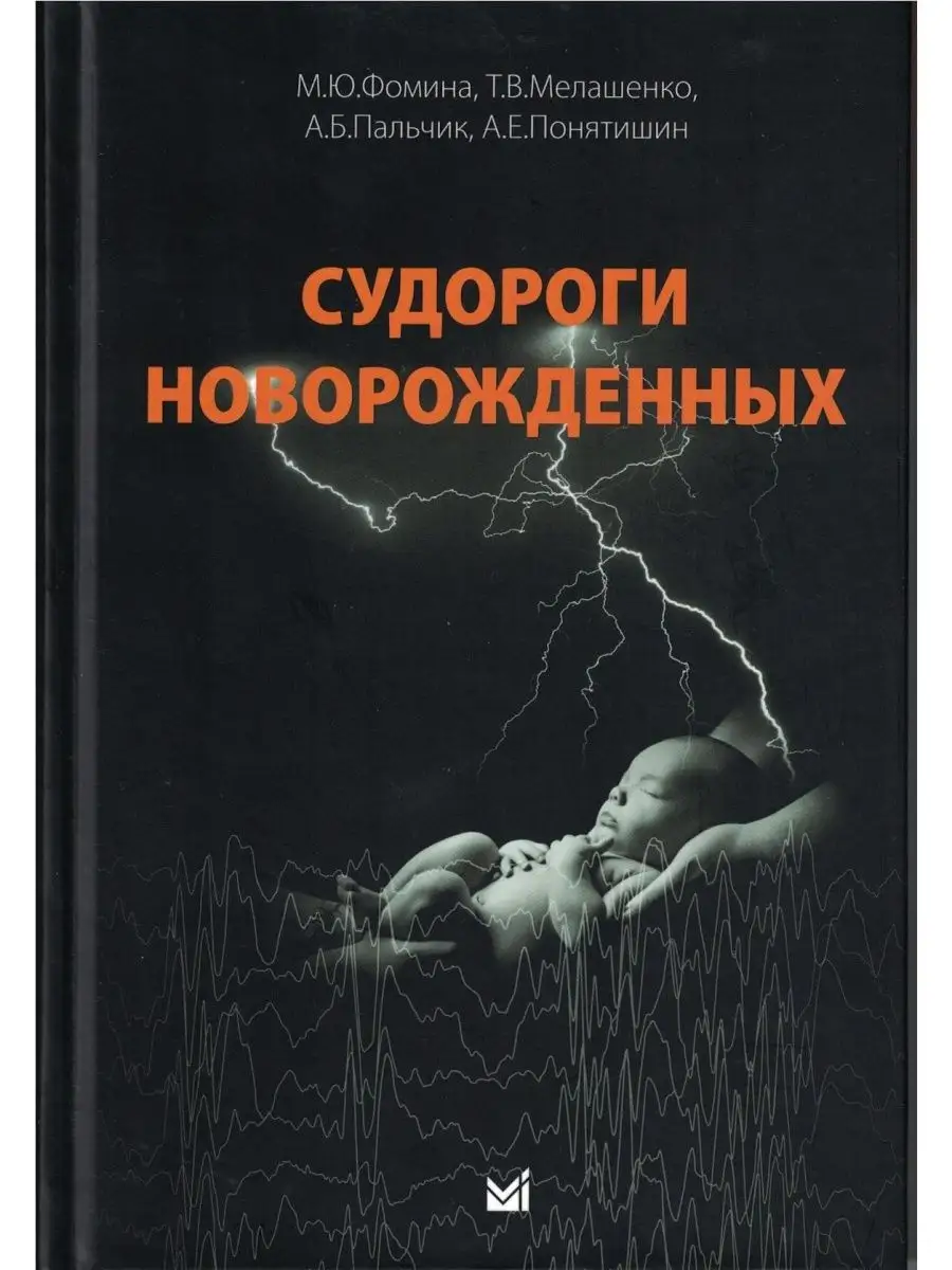 Судороги новорожденных МЕДпресс-информ 136390280 купить за 1 137 ₽ в  интернет-магазине Wildberries