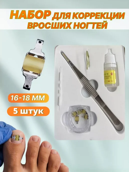 EKKEL Набор средство для коррекции вросших ногтей, 16-18мм, белый