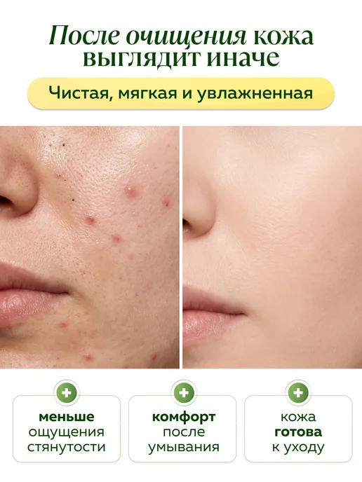 mi&ko Гидрофильное масло для лица от черных точек, черный, фото 2