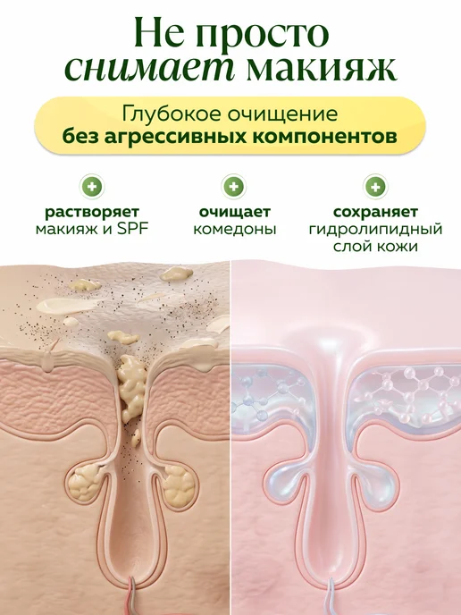 mi&ko Гидрофильное масло для лица от черных точек, черный, фото 4
