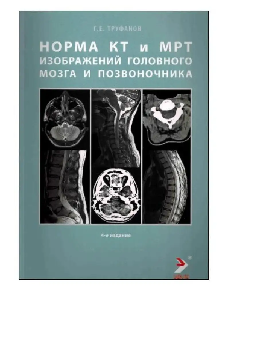 Норма КТ-и МРТ-изображений головного мозга и позвоночника ЭЛБИ-СПб  138169833 купить за 711 ₽ в интернет-магазине Wildberries