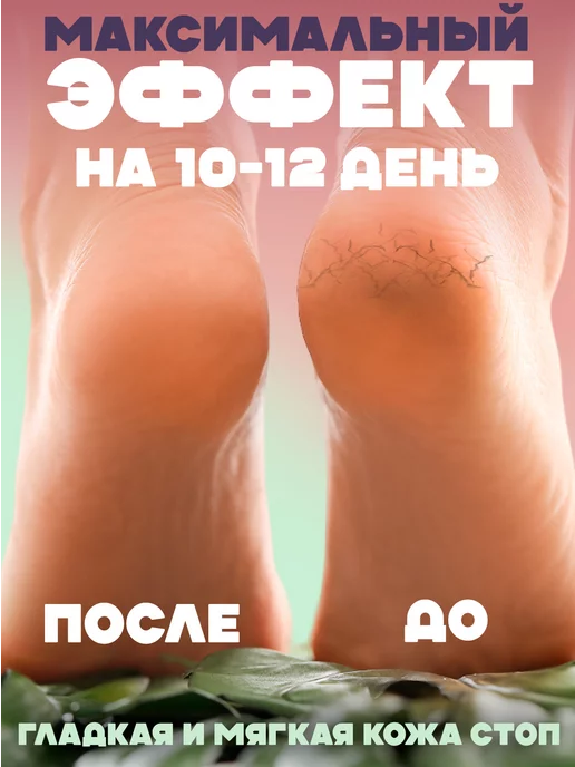 Beona Носочки педикюрные отшелушивающие 3 пары, вариант, фото 3