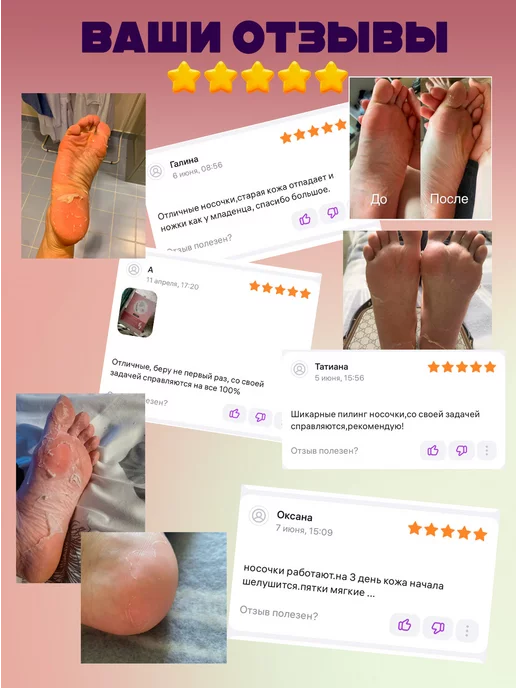 Beona Носочки педикюрные отшелушивающие 3 пары, вариант, фото 8