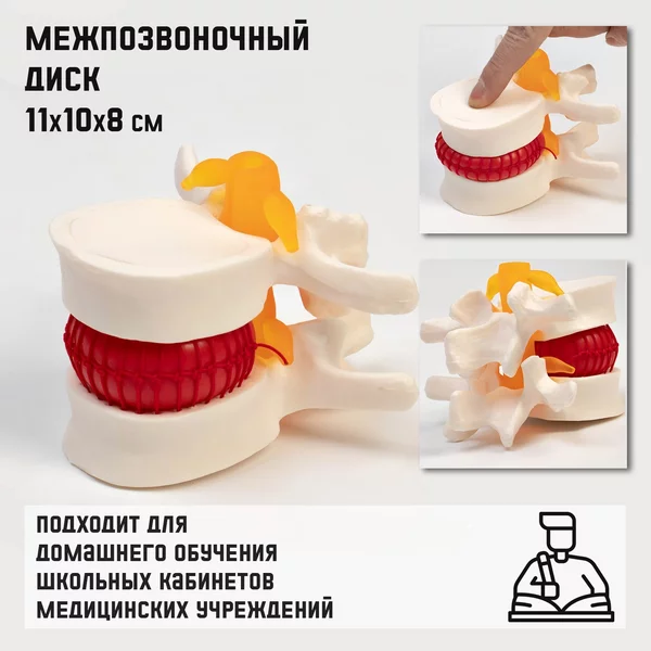 Макет Межпозвоночный диск