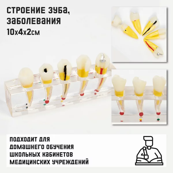 Макет Строение зуба