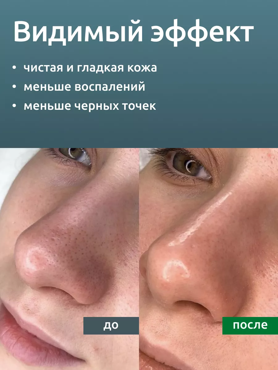 Гель для ультразвуковой чистки лица ReadySkin Care 140467004 купить за 580  ₽ в интернет-магазине Wildberries