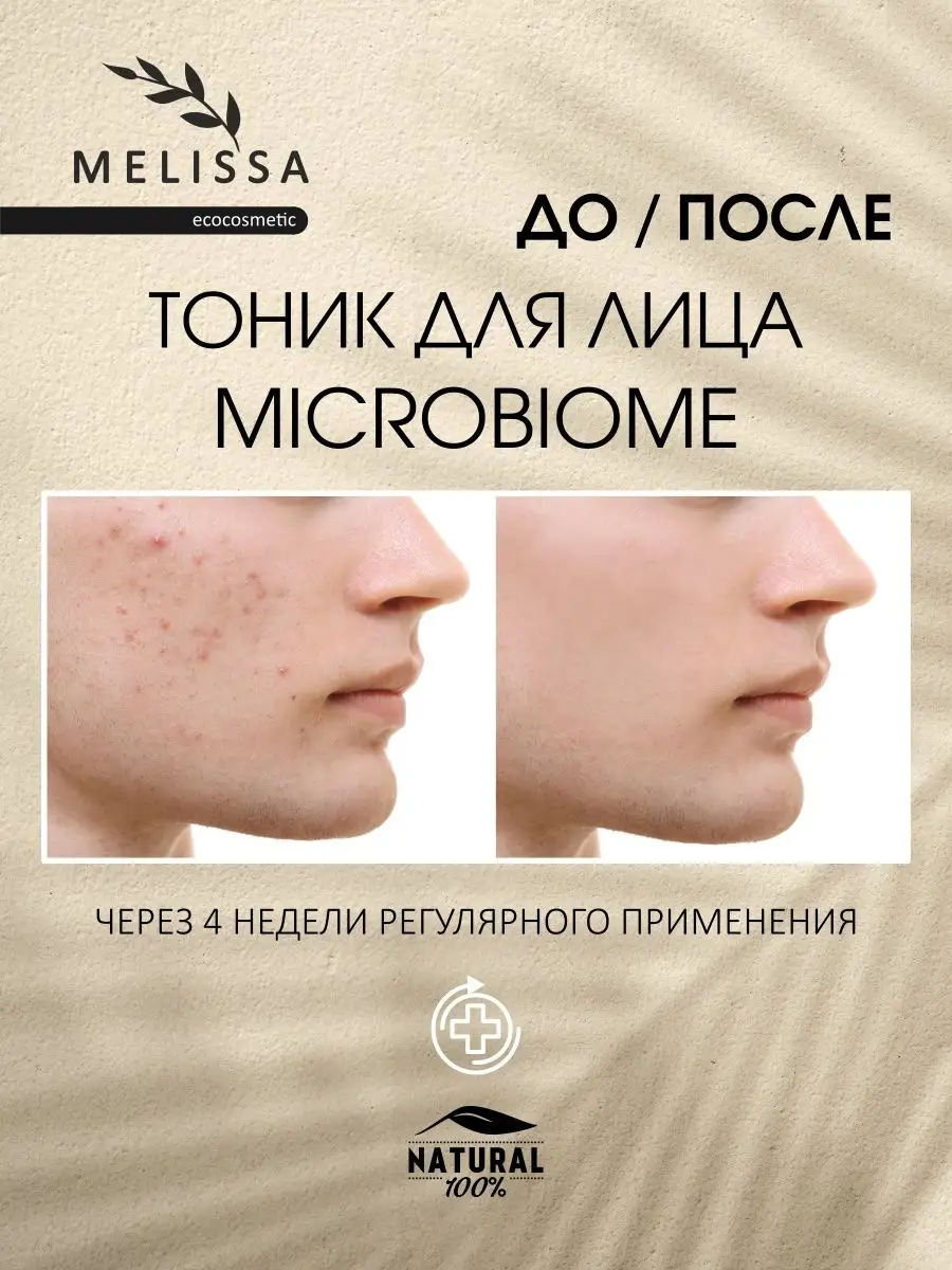 Тоник для лица Микробиом MELISSA.ecocosmetic 140986619 купить за 954 ₽ в  интернет-магазине Wildberries