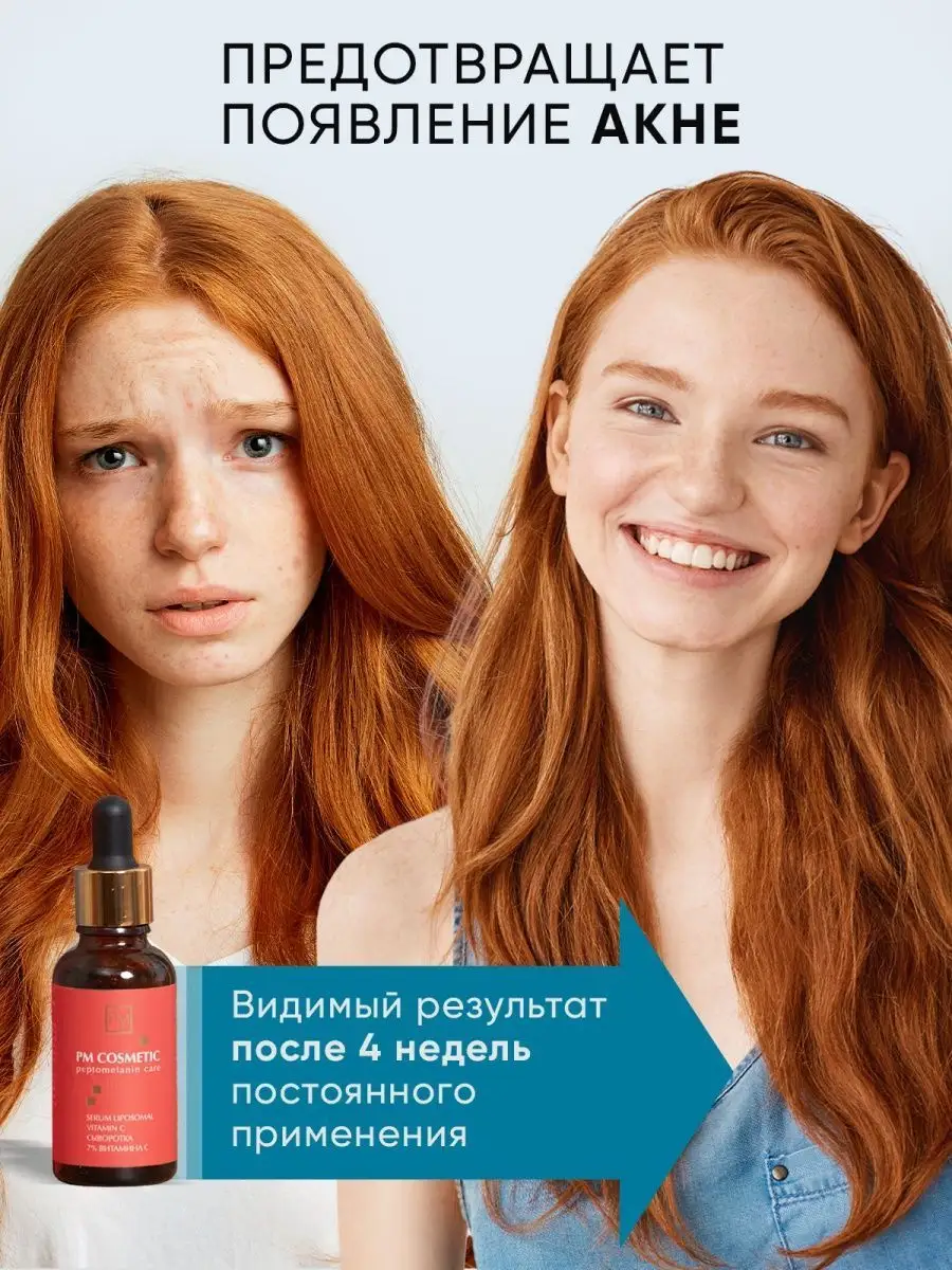 Сыворотка от прыщей с витамином С PM COSMETIC 141486161 купить в  интернет-магазине Wildberries