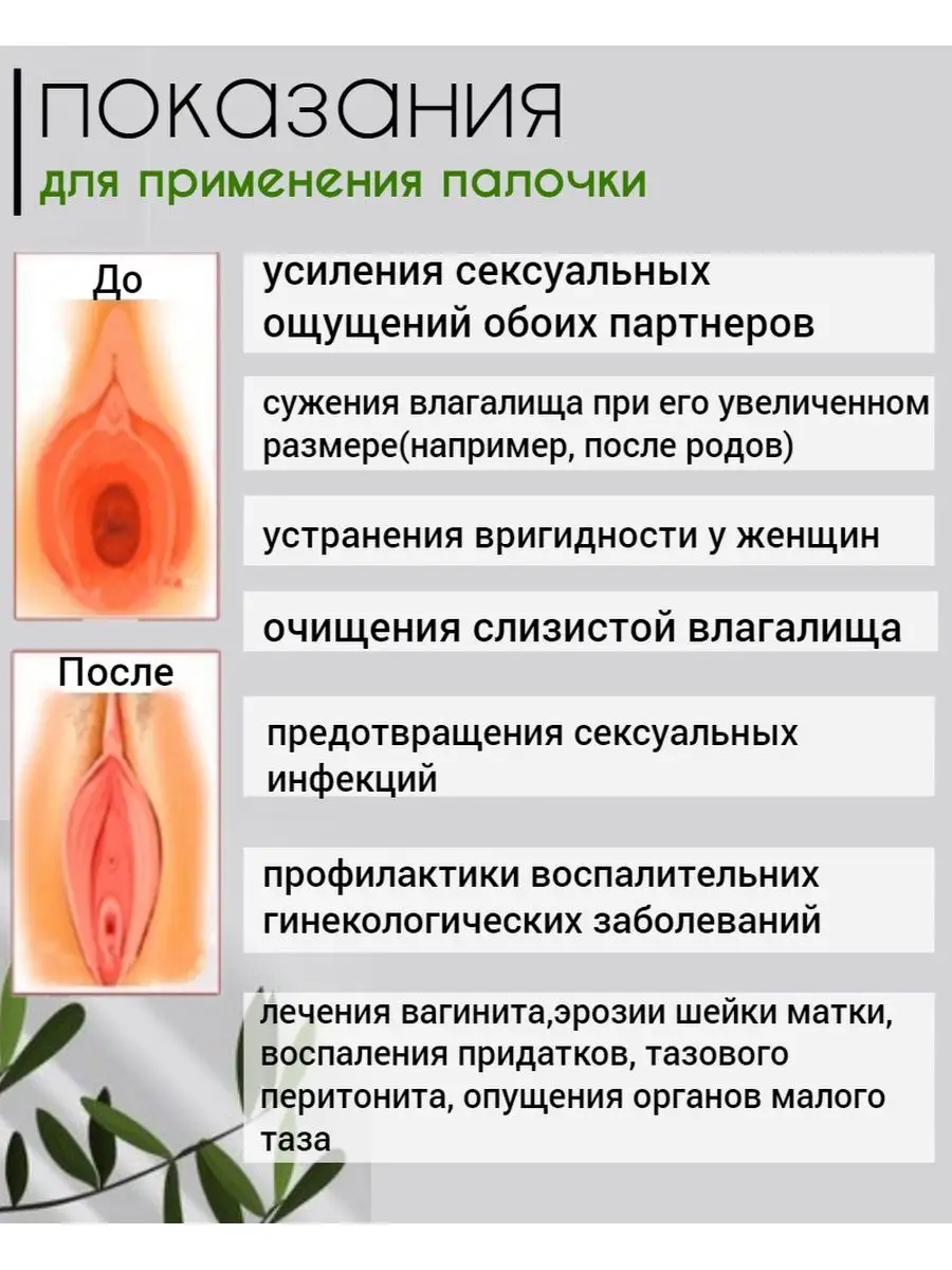 Мазок на флору у женщин