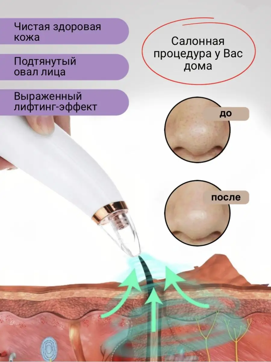 Пятна как засосы