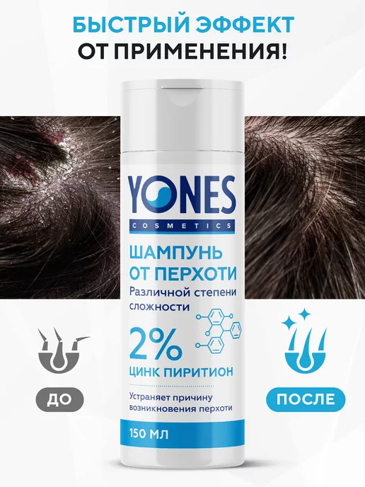Yones Шампунь от перхоти для волос с цинком 2% 150 мл, 150 мл, фото 3