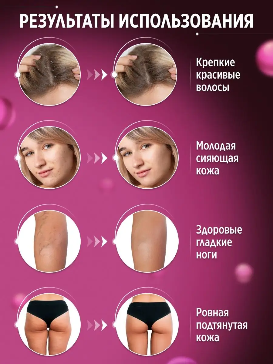 Аппарат дарсонваль для лица и тела Beauty Bang 145051912 купить в  интернет-магазине Wildberries