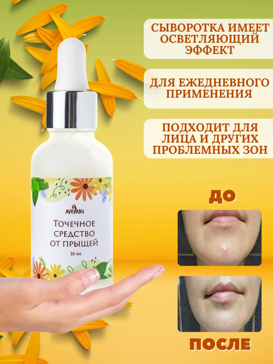 Точечное средство от прыщей и акне на лице и теле Avedan Skin 146003062  купить за 426 ₽ в интернет-магазине Wildberries