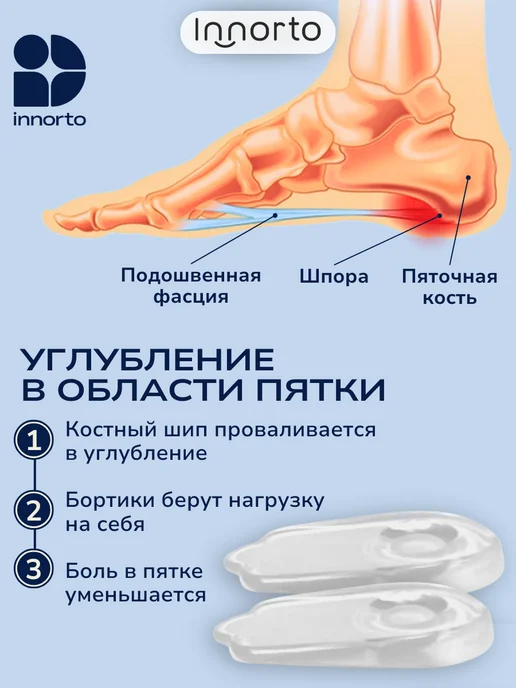 INNORTO Ортопедические стельки вальгус подпяточник, вариант, фото 2