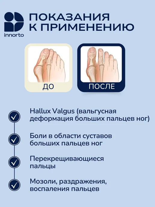 INNORTO Вальгусный корректор большого пальца, вариант, фото 3