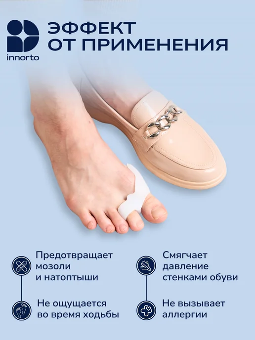 INNORTO Вальгусный корректор большого пальца, вариант, фото 7