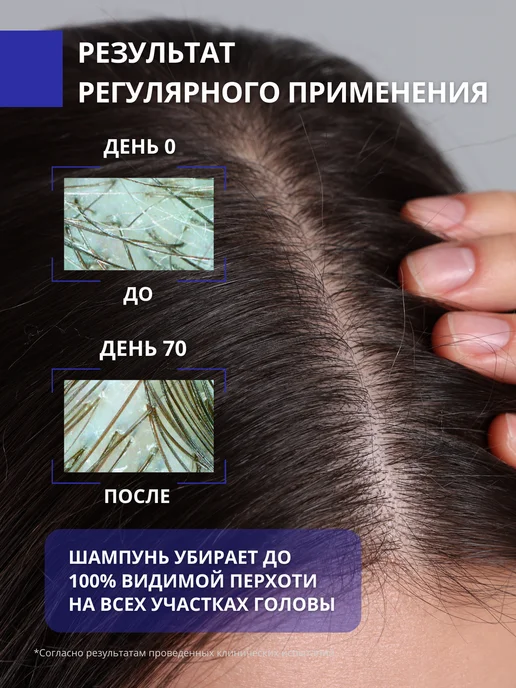 DR. MARCUS HEILER Шампунь от перхоти с климбазолом, 250 мл, фото 2