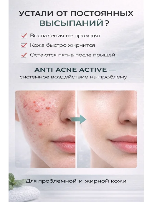 Mesaltera Лосьон для лица от прыщей Мезалтера ANTI ACNE, вариант, фото 2