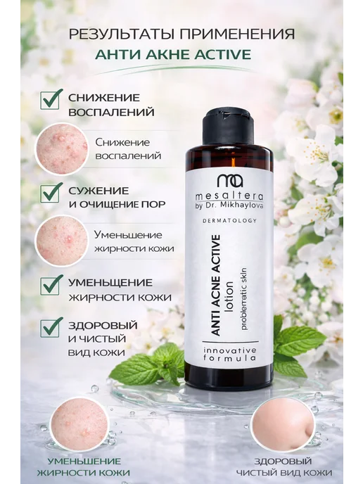 Mesaltera Лосьон для лица от прыщей Мезалтера ANTI ACNE, вариант, фото 6
