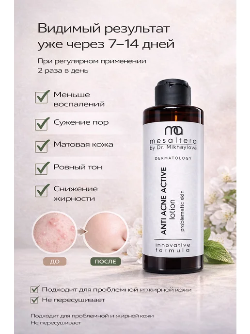 Mesaltera Лосьон для лица от прыщей Мезалтера ANTI ACNE, вариант, фото 7