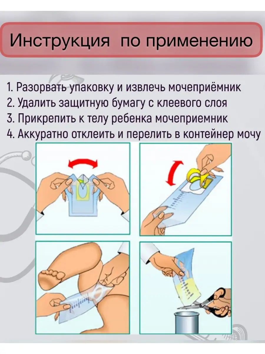 Как правильно клеить мочеприемник девочке фото Как правильно пользоваться мочеприемником - найдено 85 фото