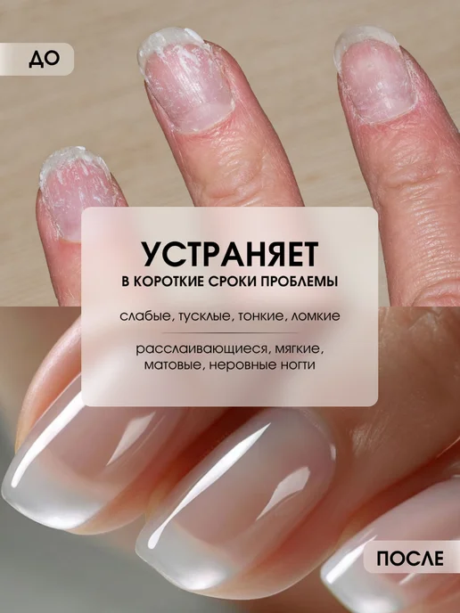 KIKI Лак для ногтей укрепляющий Здоровые и крепкие 8в1, 10 мл, фото 2