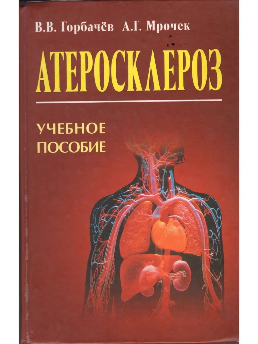 Книга атеросклероз. Книги по атеросклерозу. книги про атеросклероз.