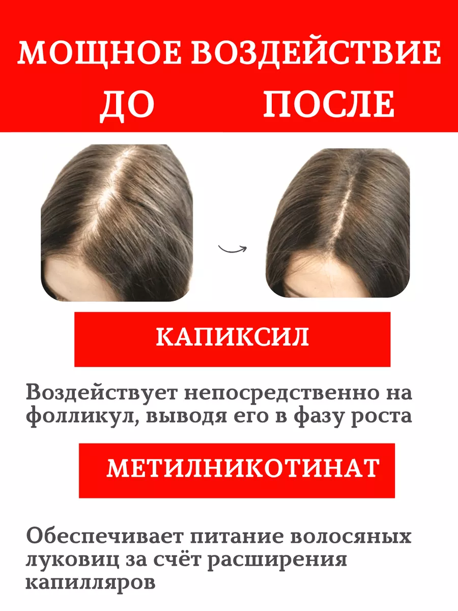 Активатор роста волос Татьянин Дом 150337030 купить за 931 ₽ в  интернет-магазине Wildberries