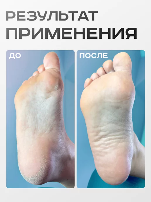 ELNAIL PRO Сменные файлы для педикюра SOFT M 320 грит Push Up, 50 шт, фото 4