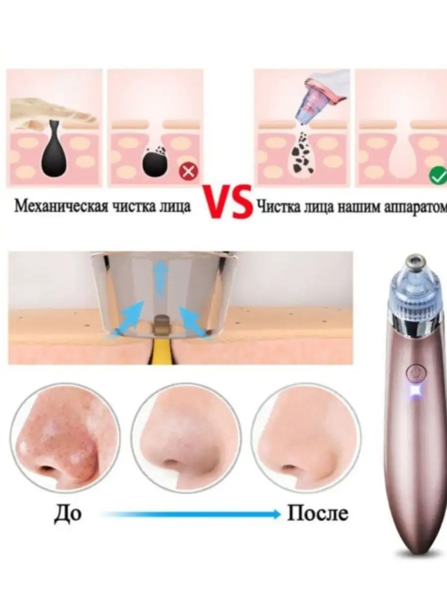 Аппарат для чистки лица Вакуумный очиститель пор от прыщей yes good  151158244 купить за 751 ₽ в интернет-магазине Wildberries
