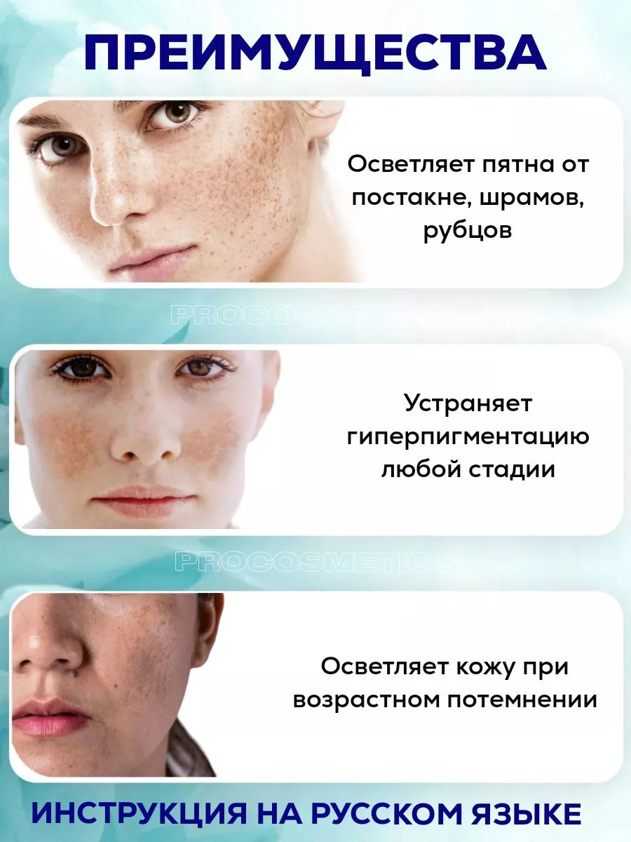 Экспигмент отбеливающий крем для лица Expigment 4% Expigment Turkey  152682612 купить в интернет-магазине Wildberries