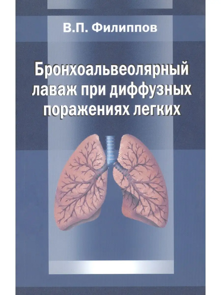 Бронхоальвеолярный лаваж при диффузных поражениях легких Медицина 152690700  купить за 774 ₽ в интернет-магазине Wildberries