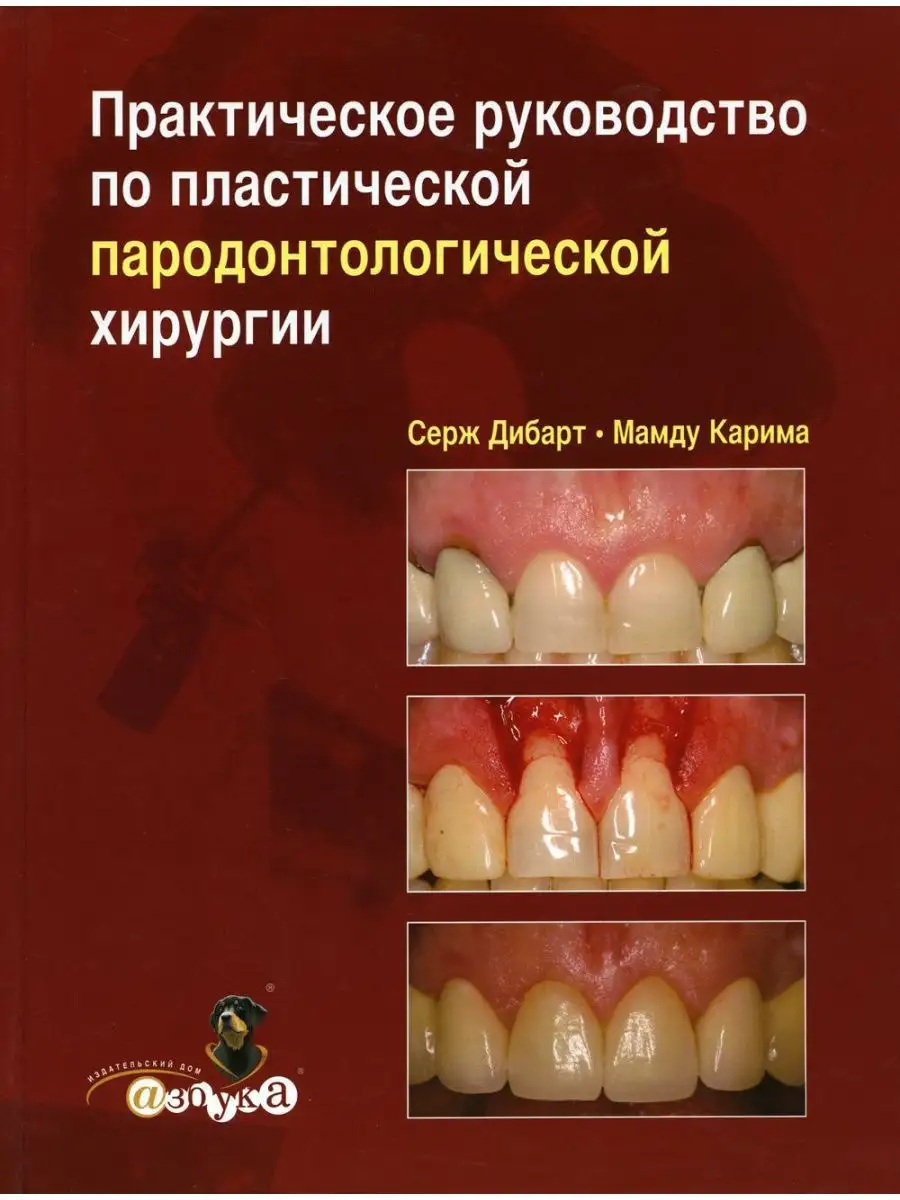 Практическое руководство по пластической парадонтолог... Азбука стоматолога  153200739 купить за 6 337 ₽ в интернет-магазине Wildberries