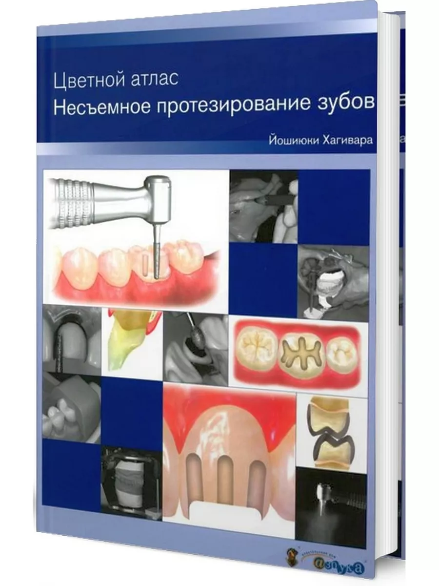 Несъемное протезирование зубов. Цветной атлас Азбука стоматолога 153200763  купить за 27 299 ₽ в интернет-магазине Wildberries