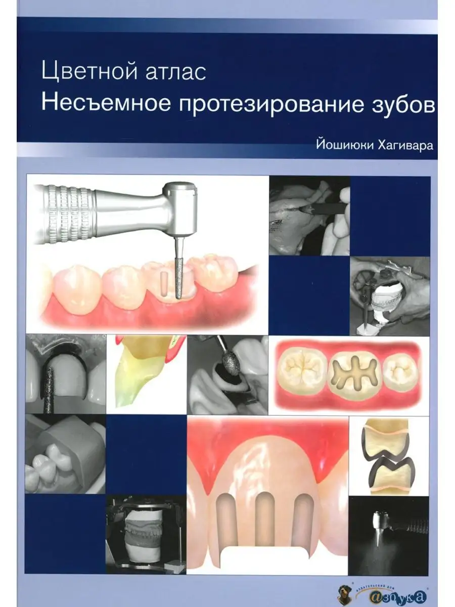 Несъемное протезирование зубов. Цветной атлас Азбука стоматолога 153200763  купить за 27 299 ₽ в интернет-магазине Wildberries