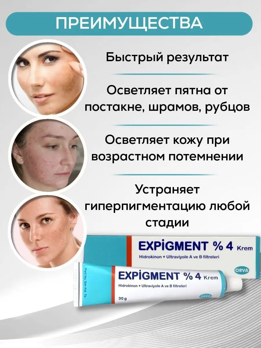 Отбеливающий крем для лица Expigment 4% от пигментациии ORVA 153316516  купить в интернет-магазине Wildberries