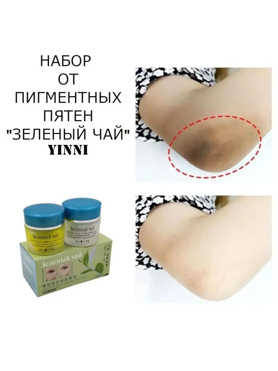 Крем Зелёный чай от пигментных пятен, набор yinni 2 в 1 Elli Cosmetics  154299597 купить за 450 ₽ в интернет-магазине Wildberries