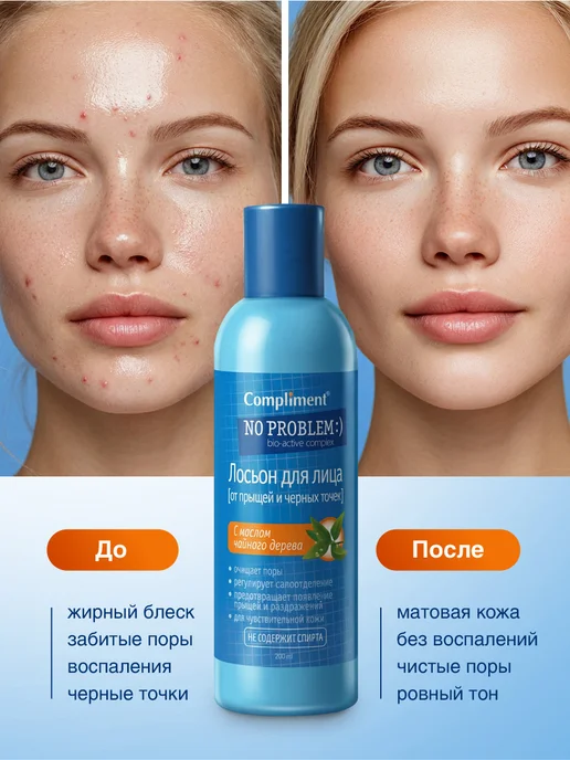 Compliment Лосьон для лица от прыщей с маслом чайного дерева 200мл, 200 мл, фото 2