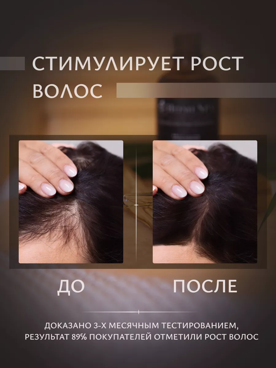 Что такое активаторы роста волос?