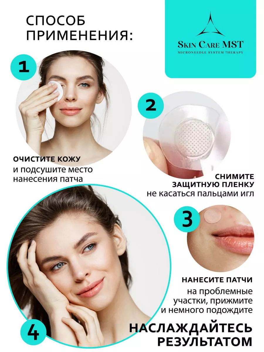 Патчи от прыщей с микроиглами Skin Care NG 157970341 купить за 510 ₽ в  интернет-магазине Wildberries