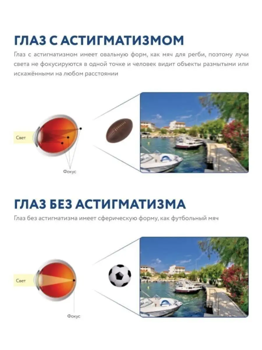 Линзы Acuvue Oasys for Astigmatism -6.50 -0.75 60 6 шт ACUVUE 158134787  купить за 2 007 ₽ в интернет-магазине Wildberries